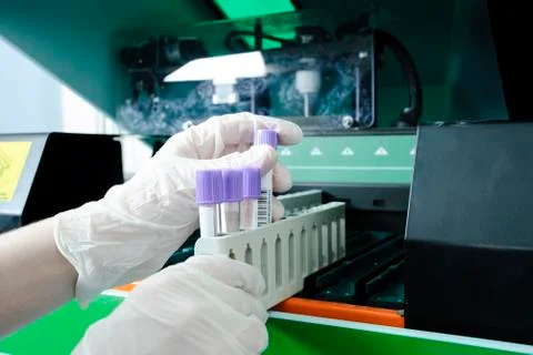 Serum analyzer Stock Photos