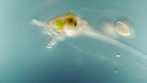 Sessile Collotheca Rotifer - DIC Microscopy, Crown Cilia Movement Stock Footage 319077555