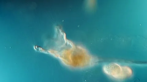 Sessile Collotheca Rotifer - DIC Microscopy, Crown Cilia Movement Stock Footage 319077793