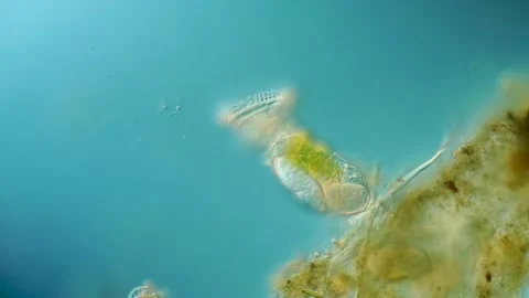 Sessile rotifer under DIC microscopy with visible cilia and body structure Stock Footage 315970155