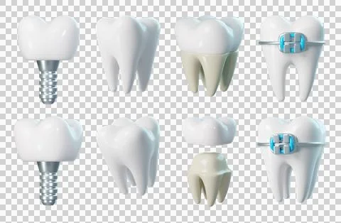 Set of 3d tooth Stock Illustration