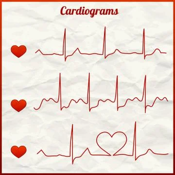 Set of cardiograms Stock Illustration