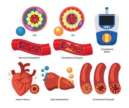 Set of cholesterol elements objects set collection with HDL and LDL lipopro.. Stock Illustration