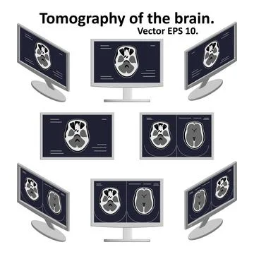 Set of cross section of brain during magnetic resonance imaging on computer Illustrazione stock