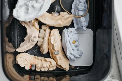 Set of dental casts close up view Foto stock