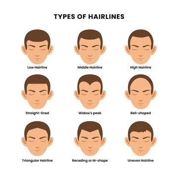 Set different types of hairlines poster with low, middle, high, straight-li.. 스톡 일러스트