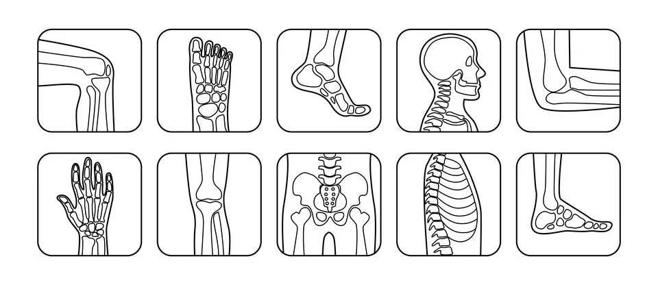 Set of different types of human bone doodle outline poster, Joint disease p.. Stock-Illustration