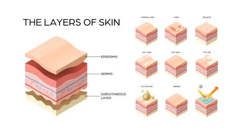 Set different types skin layers cross-section of human skin structure skincare Stock Illustration