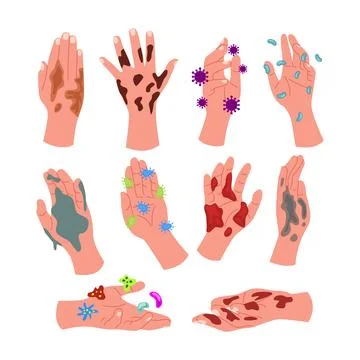 Set of dirty hands set collection, hand with many germs in mud and soil dir.. Stock Illustration