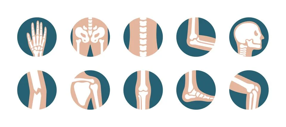 Set of human joints and bones. Vector knee, leg, pelvis, scapula, skull, elbow Stock Illustration