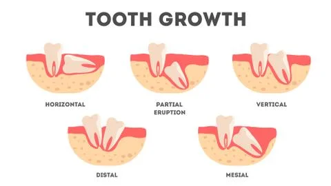 Set of human teeth in diffrent condition. Dental health and disease concept. Stockillustratie