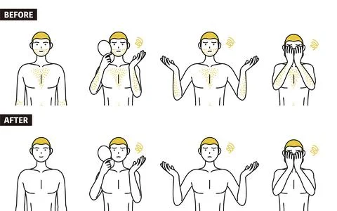 Set of line drawing poses of a man suffering from thick body hair, poses of a Stock Illustration