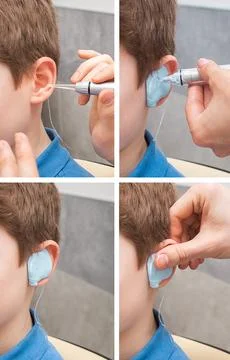 Set of making a custom earplug for a boy. Stages of manufacturing earplugs. D Stock-Fotos