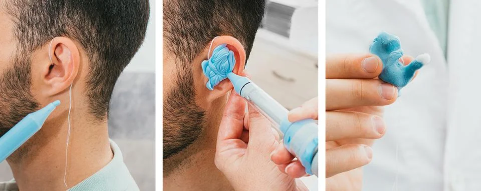 Set of making a custom earplug for a man. Stages of manufacturing earplugs... Foto stock