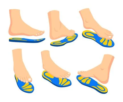 Set of Orthopedic Insole collection with different angle or view. Orthotic .. Stock Illustration