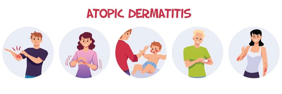 Set of people with atopic dermatitis flat style, vector illustration 库存插图