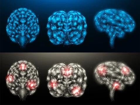 Set of polygonal vector illustrations of a healthy brain and a diseased brain Stock Illustration
