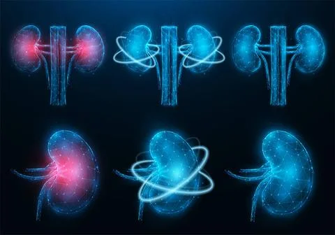  Set of polygonal vector illustrations of inflamed diseased kidney, health... Stock Photos
