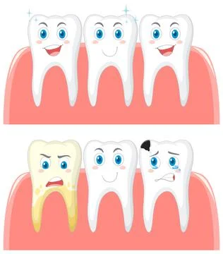 Set of strong teeth and tooth decay on white background Stock Illustration