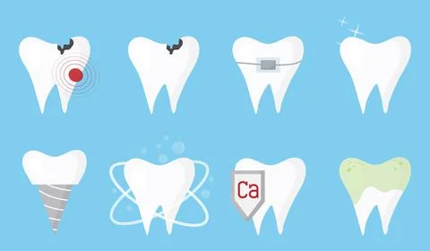 A set of teeth. Clean, dirty, sick, teeth. Stock Illustration