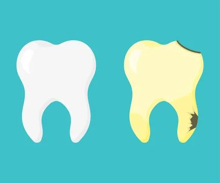 Set teeth healthy and sick in flat Stock Illustration