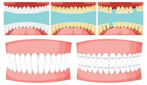 Set of teeth inside human mouth with human teeth model Ilustración de archivo