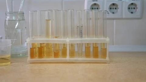 Set of test tubes close-up in laboratory in plastic box holder. Foto stock