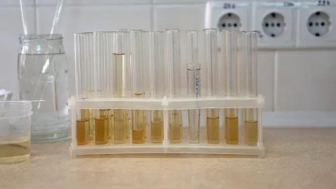 Set of test tubes close-up in laboratory in plastic box holder. Foto stock