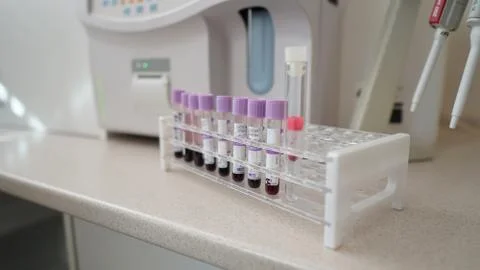 Set of test tubes close-up in laboratory in plastic box holder. 스톡 사진