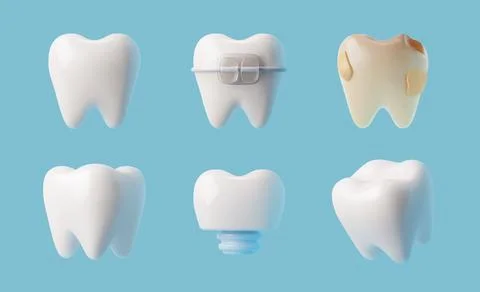 Set of various realistic teeth 3D style, vector illustration Illustrazione stock