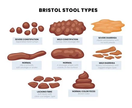 Set of various types human feces - constipation, normal and diarrhea. Brist.. Illustrazione stock
