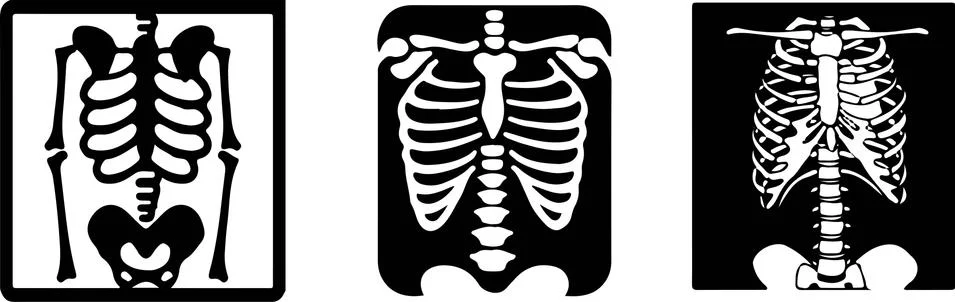 Set of x-ray of human vector on black and white background Stock Illustration