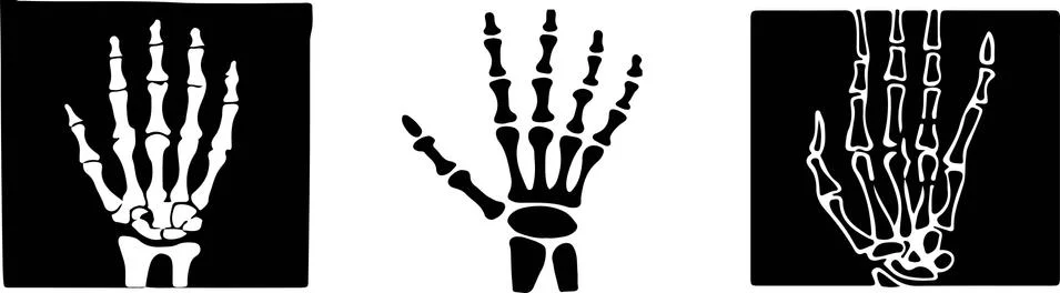 Set of x-ray of human vector on black and white background Stock Illustration