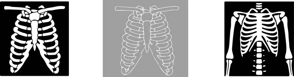 Set of x-ray of human vector on black and white background Stock Illustration