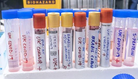 Several vials of blood samples positive for covid-19 infection of the new var Stock Photos