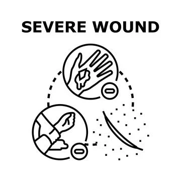 Severe wound concept depicting different injuries Stock Illustration