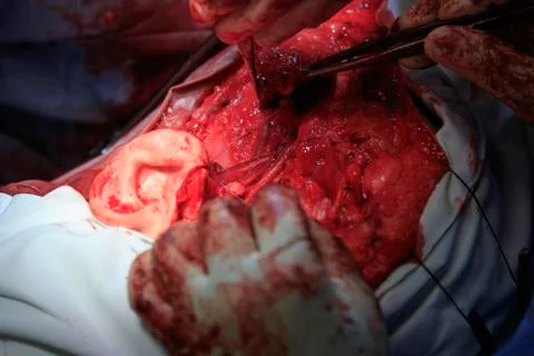 Sew down the ear Foto stock