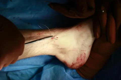 Sewing Ankle Cut Close-up Stockfoto's