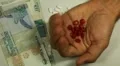 Seychellois Rupee SCR, Counting Drugs and Money, Health Care, Colorful Pills HD Footage