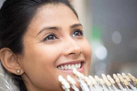 Shade guide to teeth, selection process Stock-Fotos