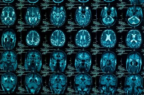 Sharp ct scan of the human brain Stock Photos