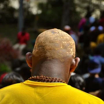 Shaved head of a HIndu devotee at Thaipusam festival. Foto stock