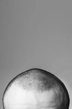Shaved man. Upper part of the head close-up Stock Photos