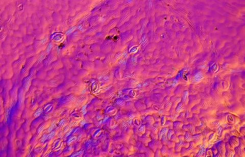 Sheet underside with stomata as a varnish impression in Rheinberg lighting Stock Photos