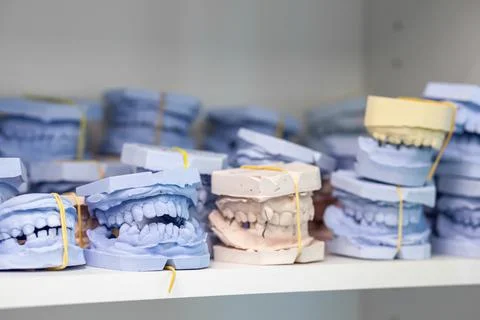 Shelf with lying on her casts of teeth and prosthetic and restorations Stock Photos