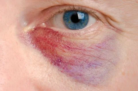 Shiner Stock Photos