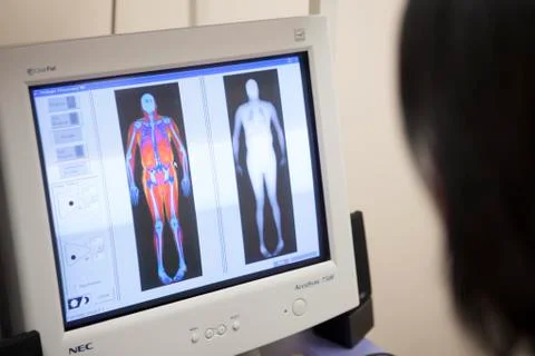 Shot of computer screen with body scan Stock Photos
