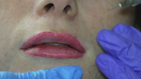 A Shot that Increases Lip Stock Footage 65989841