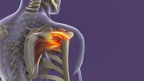 Shoulder Joint Inflammation Due to Rotator Cuff Strain Stock Illustration