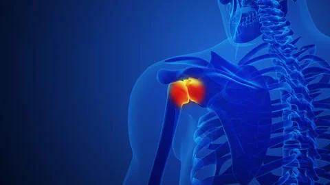 Shoulder Joint Pain with blue background Video stock 274386715